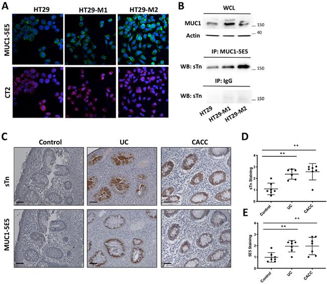 ST6GALNAC1 Antibody in Immunohistochemistry (IHC)