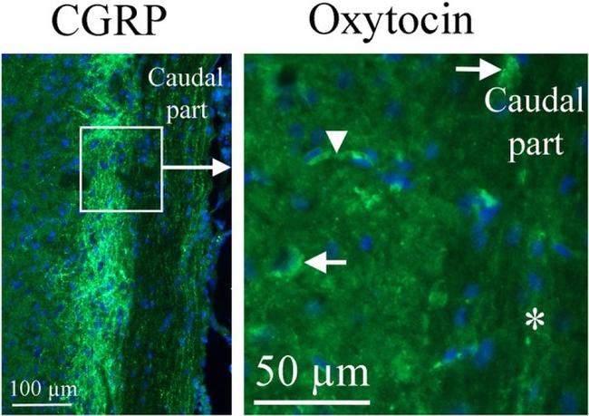 Oxytocin Antibody in Immunohistochemistry (IHC)