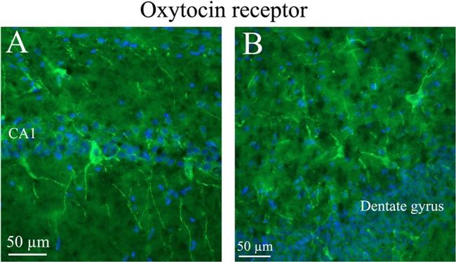 Oxytocin Antibody in Immunohistochemistry (IHC)