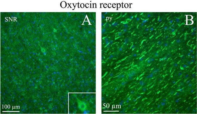 Oxytocin Antibody in Immunohistochemistry (IHC)