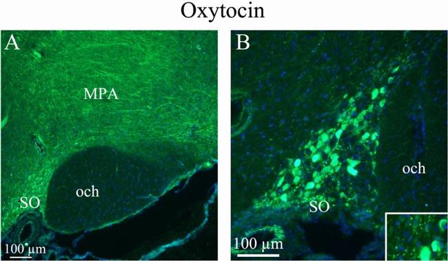 Oxytocin Antibody in Immunohistochemistry (IHC)