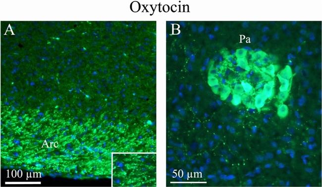 Oxytocin Antibody in Immunohistochemistry (IHC)