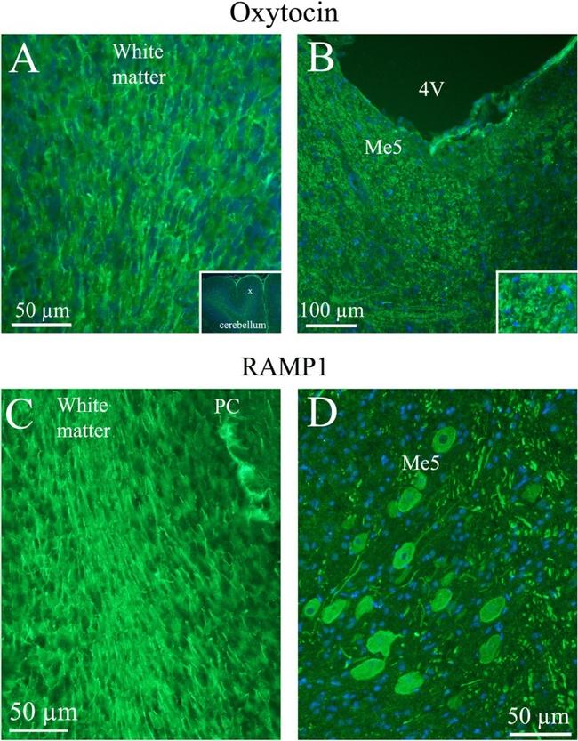 Oxytocin Antibody in Immunohistochemistry (IHC)