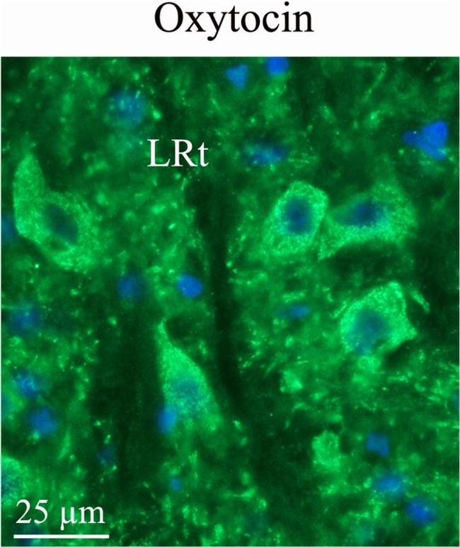 Oxytocin Antibody in Immunohistochemistry (IHC)