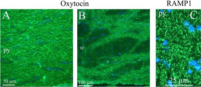 Oxytocin Antibody in Immunohistochemistry (IHC)