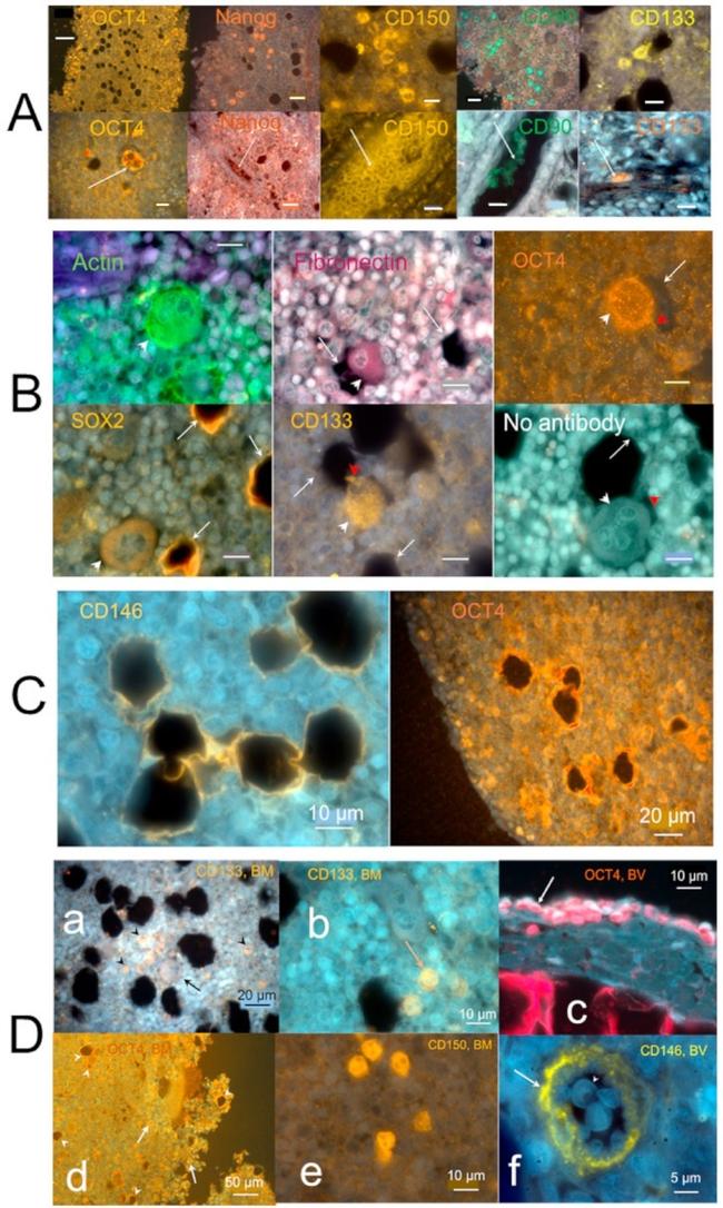 Nanog Antibody in Immunohistochemistry (IHC)