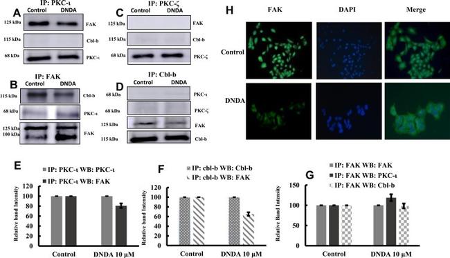 FAK Antibody in Western Blot, Immunoprecipitation (WB, IP)