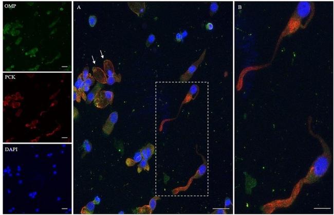 Cytokeratin Pan Antibody in Immunocytochemistry (ICC/IF)