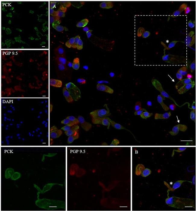 Cytokeratin Pan Antibody in Immunocytochemistry (ICC/IF)