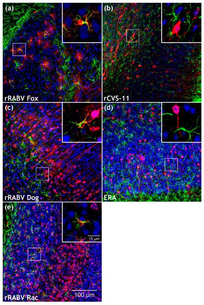 GFAP Antibody in Immunohistochemistry (IHC)