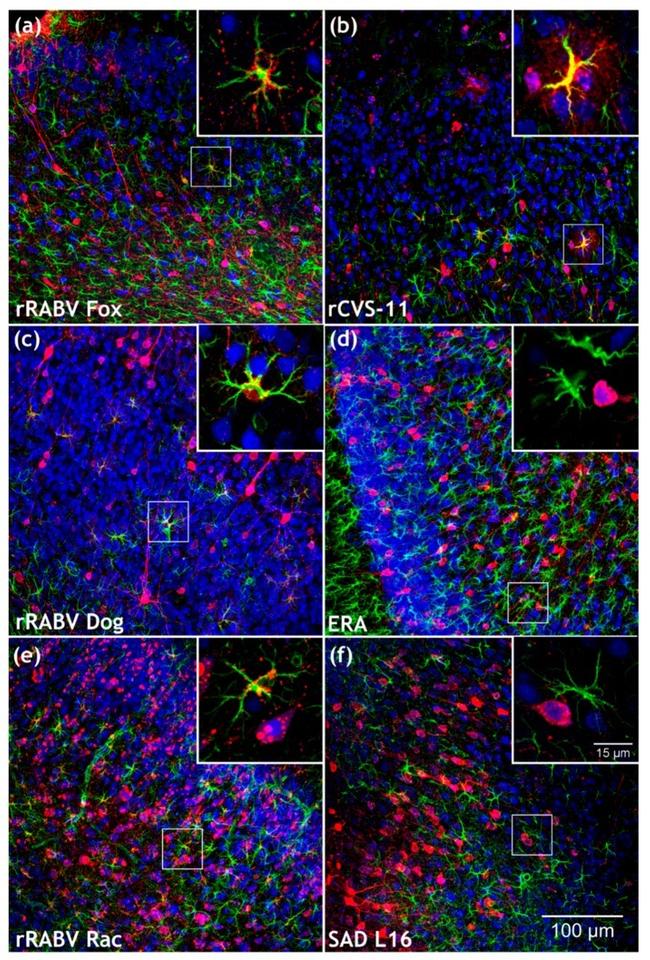 GFAP Antibody in Immunohistochemistry (IHC)