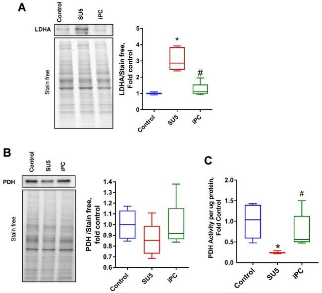 PDHA1 Antibody in Western Blot (WB)