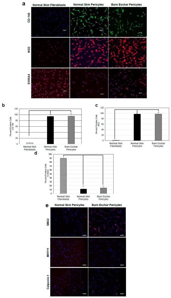 Calponin 1 Antibody in Immunocytochemistry (ICC/IF)