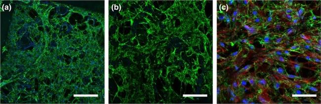 Fibronectin Antibody in Immunocytochemistry (ICC/IF)