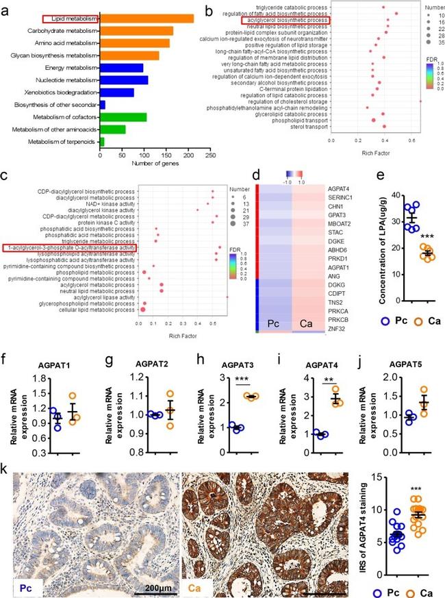 AGPAT4 Antibody in Immunohistochemistry (IHC)