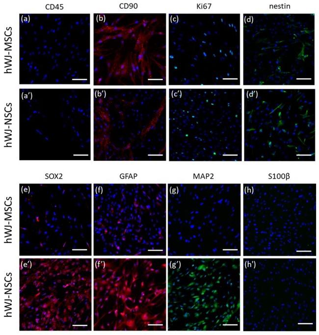 GFAP Antibody in Immunocytochemistry (ICC/IF)