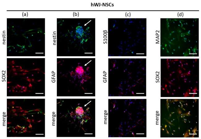 GFAP Antibody in Immunocytochemistry (ICC/IF)