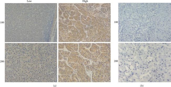 KIF15 Antibody in Immunohistochemistry (IHC)