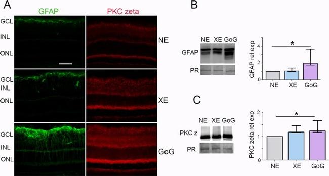 PKC zeta Antibody in Western Blot, Immunohistochemistry (WB, IHC)