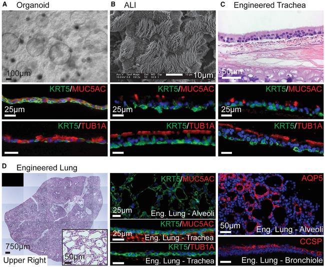 MUC5AC Antibody in Immunohistochemistry (IHC)