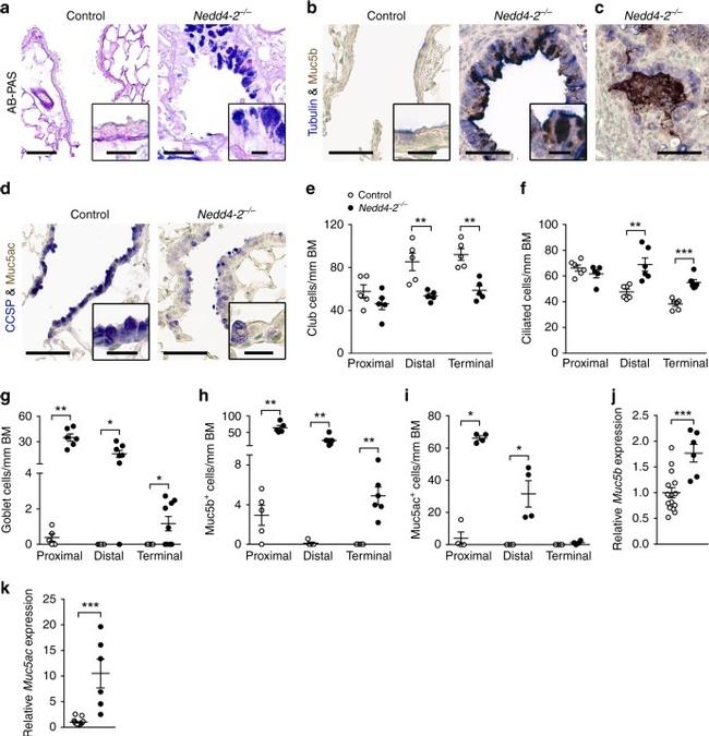 Acetyl-alpha Tubulin (Lys40) Antibody in Immunohistochemistry (IHC)