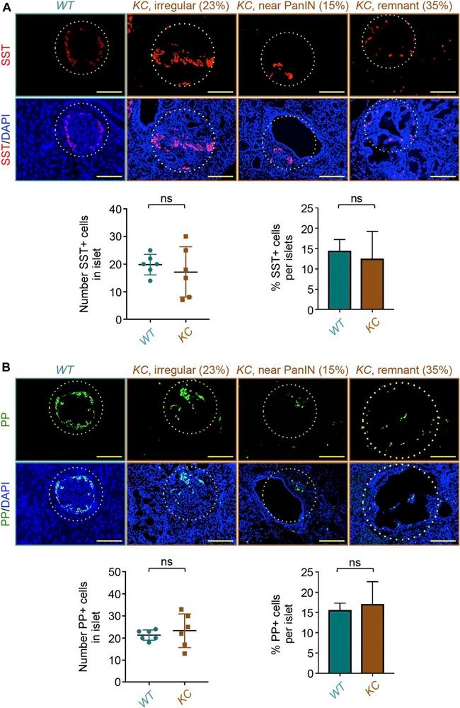 Somatostatin Antibody in Immunohistochemistry, Immunohistochemistry (Paraffin) (IHC, IHC (P))