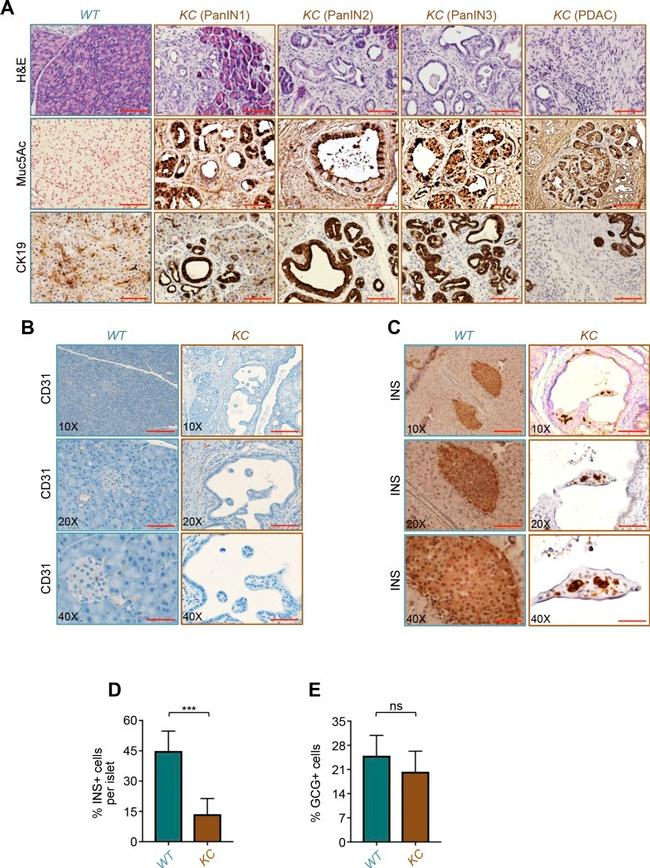 MUC5AC Antibody in Immunohistochemistry, Immunohistochemistry (Paraffin) (IHC, IHC (P))