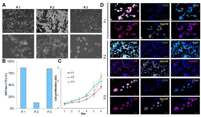 Vimentin Antibody in Immunohistochemistry (IHC)