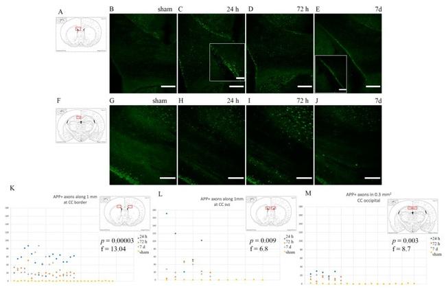 beta Amyloid Antibody in Immunohistochemistry (IHC)