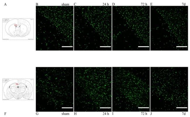 beta Amyloid Antibody in Immunohistochemistry (IHC)