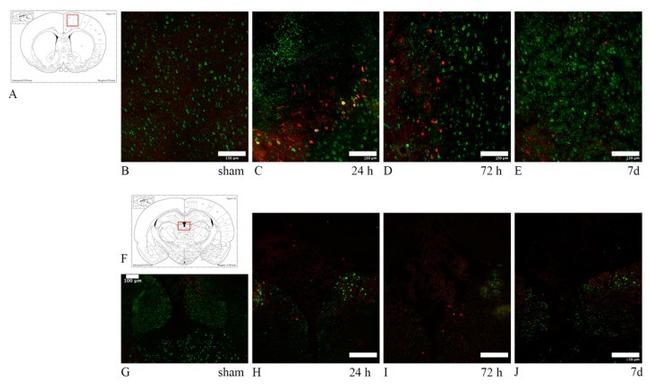 beta Amyloid Antibody in Immunocytochemistry, Immunohistochemistry (ICC/IF, IHC)