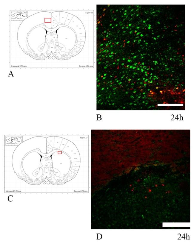 beta Amyloid Antibody in Immunocytochemistry, Immunohistochemistry (ICC/IF, IHC)