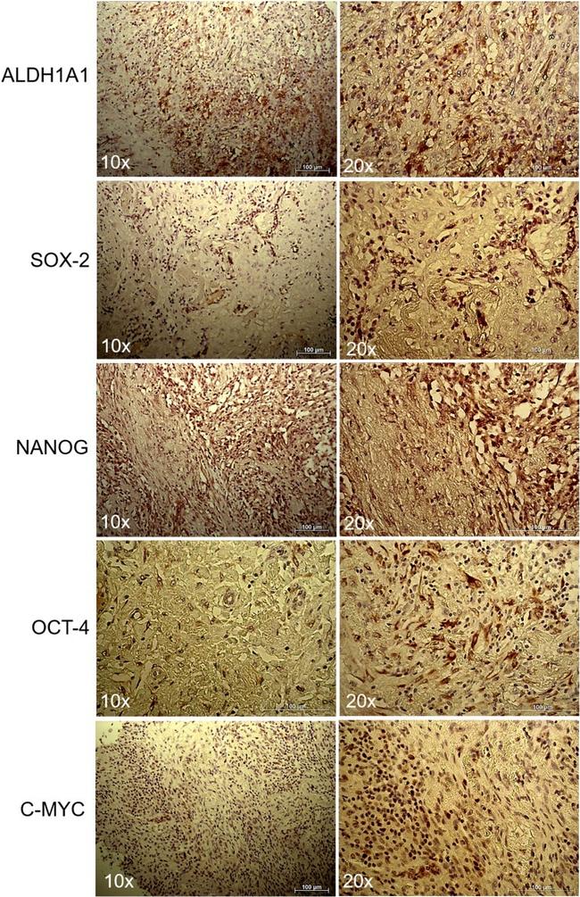 SOX2 Antibody in Immunohistochemistry (IHC)