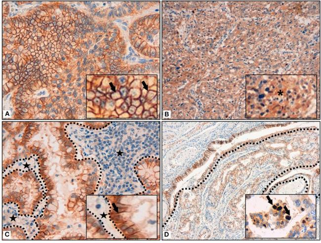 alpha Adaptin Antibody in Immunoprecipitation (IP)