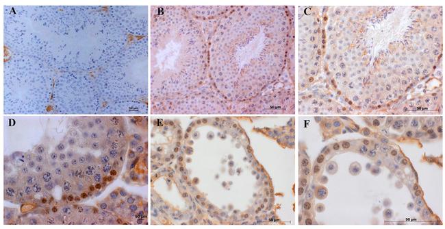 Claudin 1 Antibody in Immunohistochemistry (IHC)