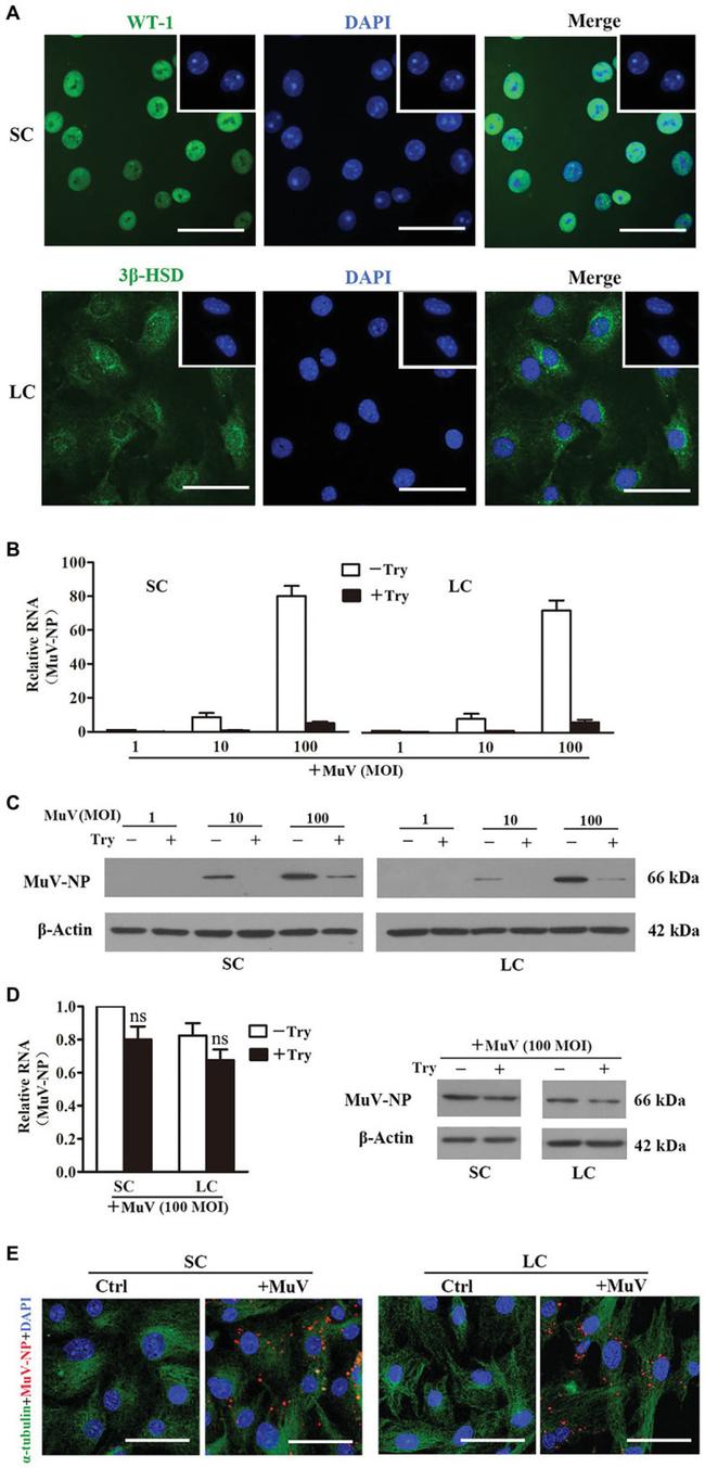 TECK Antibody in Immunohistochemistry (IHC)