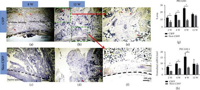 CD31 Antibody in Immunohistochemistry (IHC)