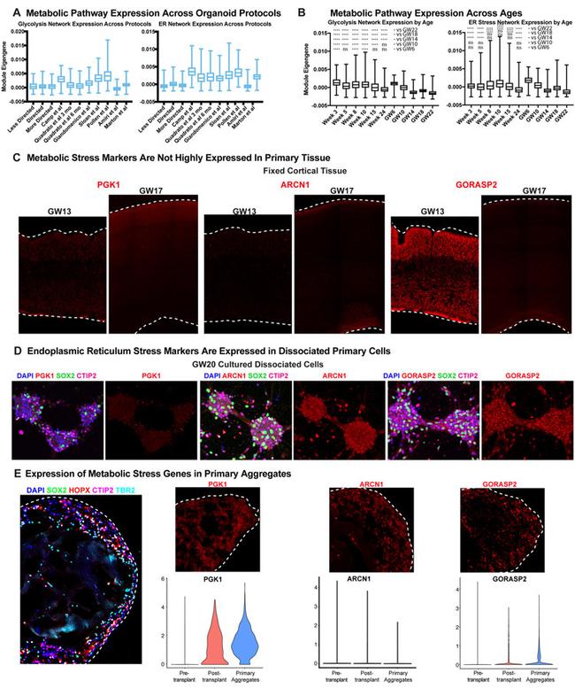 PGK1 Antibody in Immunohistochemistry (IHC)