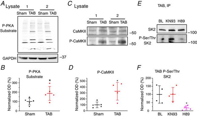 CaMKII alpha Antibody in Western Blot (WB)