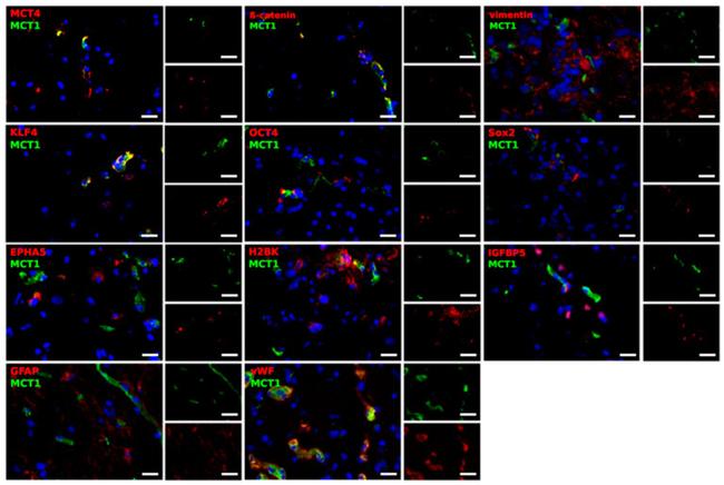 KLF4 Antibody in Immunocytochemistry (ICC/IF)