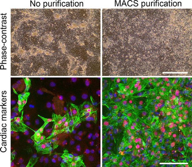 Cardiac Troponin T Antibody in Immunocytochemistry (ICC/IF)