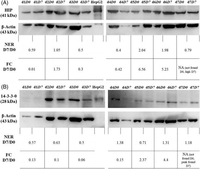 14-3-3 theta Antibody in Western Blot (WB)