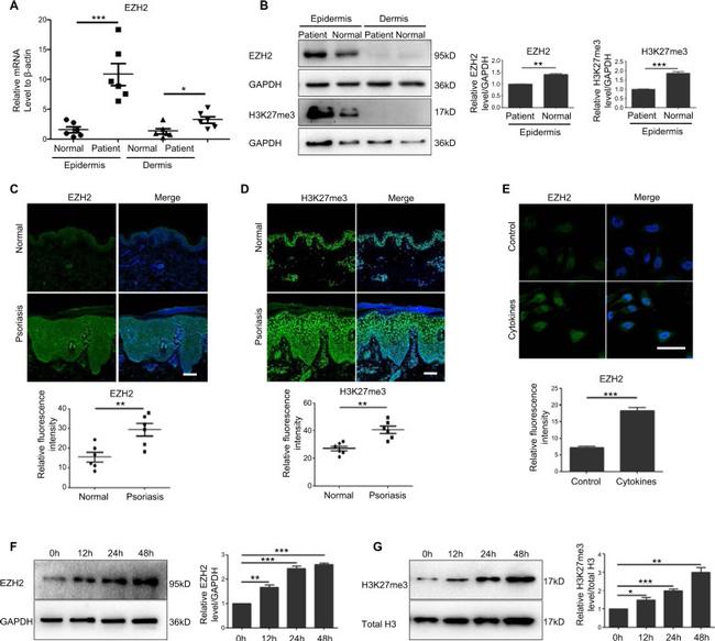 EZH2 Antibody in Immunohistochemistry (IHC)