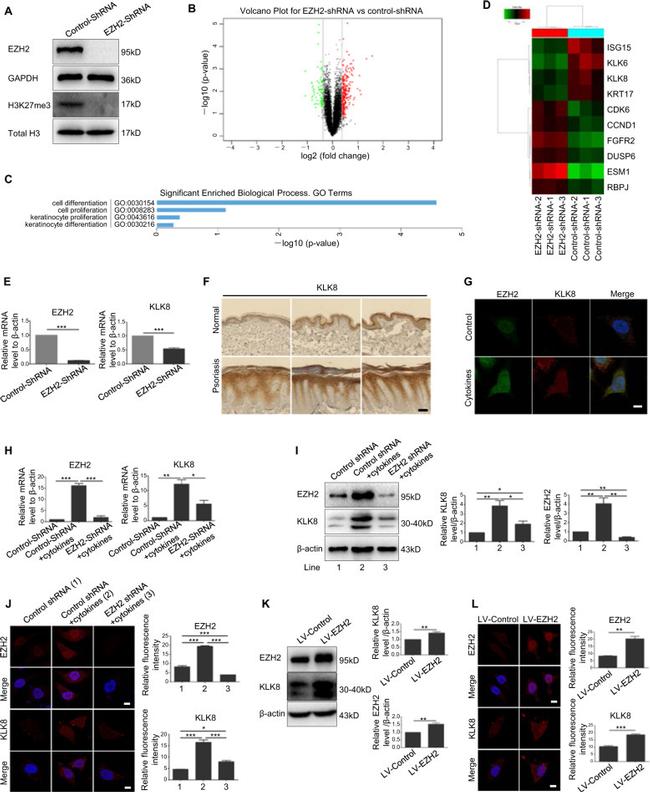 EZH2 Antibody in Immunocytochemistry (ICC/IF)