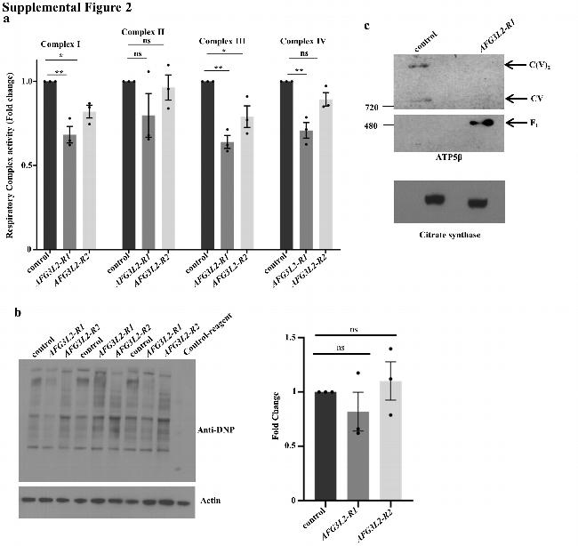 ATP Synthase beta Antibody in Western Blot (WB)