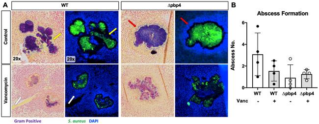 Staphylococcus aureus Antibody in Immunohistochemistry (IHC)