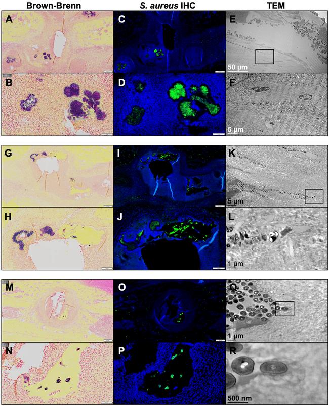 Staphylococcus aureus Antibody in Immunohistochemistry (IHC)