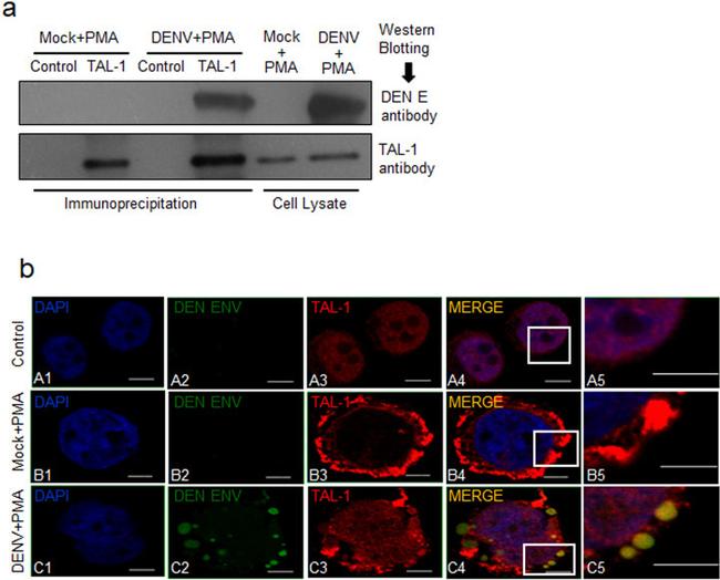 TAL1 Antibody in Western Blot, Immunocytochemistry, Immunoprecipitation (WB, ICC/IF, IP)