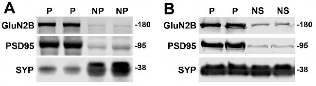 DAPK1 Antibody in Western Blot (WB)