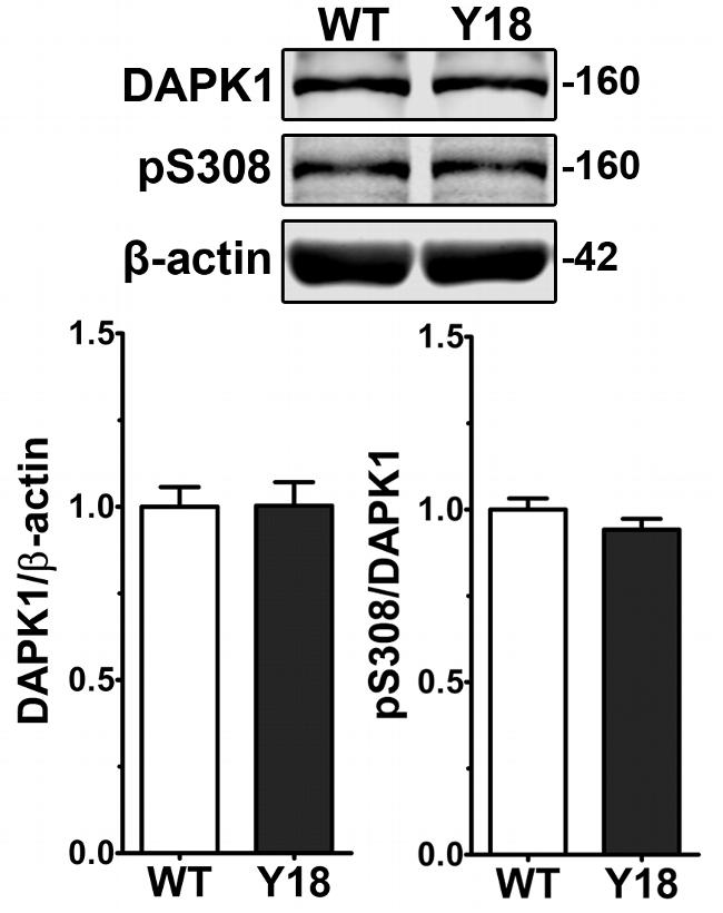 DAPK1 Antibody in Western Blot (WB)